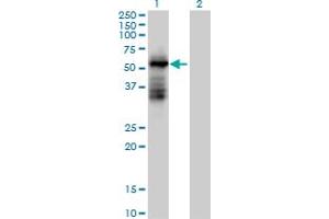 Western Blot analysis of TRIM39 expression in transfected 293T cell line by TRIM39 MaxPab polyclonal antibody. (TRIM39 抗体  (AA 1-488))