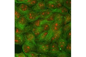 anti-Ribosomal RNA Processing 1 Homolog B (RRP1B) (AA 20-727) antibody