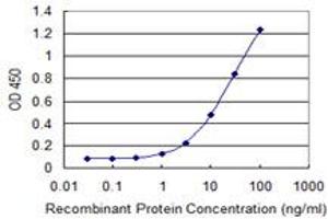 Detection limit for recombinant GST tagged TAGLN is 0. (Transgelin 抗体  (AA 19-112))