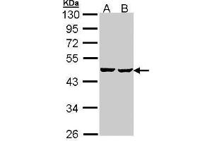 WB Image Sample (30 ug of whole cell lysate) A: Hep G2 , B: Molt-4 , 10% SDS PAGE antibody diluted at 1:1000 (SUCLA2 抗体)