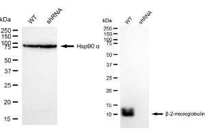 Western blotting analysis using beta 2 Microglobulin antibody (ABIN7797763). (Recombinant beta-2 Microglobulin 抗体)