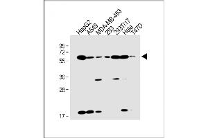 All lanes : Anti-SLC47A1 Antibody (C-term) at 1:2000 dilution Lane 1: HepG2 whole cell lysate Lane 2: A549 whole cell lysate Lane 3: MDA-MB-453 whole cell lysate Lane 4: 293 whole cell lysate Lane 5: 293T/17 whole cell lysate Lane 6: Hela whole cell lysate Lane 7: T47D whole cell lysate Lysates/proteins at 20 μg per lane. (SLC47A1 抗体  (C-Term))