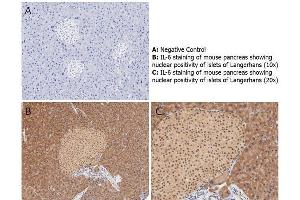 Immunohistochemistry (IHC) image for anti-Interleukin 6 (IL6) antibody (ABIN964780)