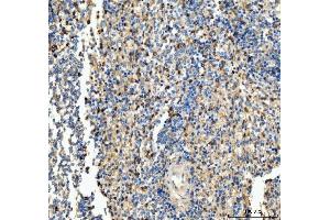 IHC analysis of CD63 using anti-CD63 antibody (ABIN3043395).