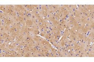 Detection of MOG in Mouse Spinal cord Tissue using Polyclonal Antibody to Myelin Oligodendrocyte Glycoprotein (MOG) (MOG 抗体  (AA 30-149))