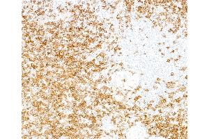 Immunohistochemistry (IHC) image for anti-Biotin antibody (ABIN7795728) (Recombinant Biotin 抗体)