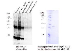 Image no. 3 for Proteolipid Protein 1 (PLP1) (AA 2-277) protein (ABIN3084135)