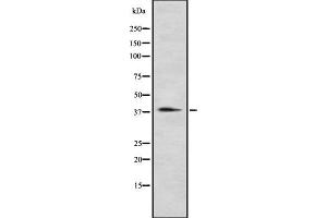 Western blot analysis P2RY12 using Jurkat whole cell lysates. (P2RY12 抗体)