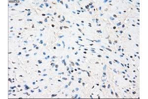 Immunohistochemistry (IHC) image for anti-Zinc Finger Protein 36, C3H Type, Homolog (Mouse) (ZFP36) antibody (ABIN2734315)