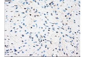 Immunohistochemical staining of paraffin-embedded Ovary tissue using anti-ZFP36 mouse monoclonal antibody. (ZFP36 抗体)