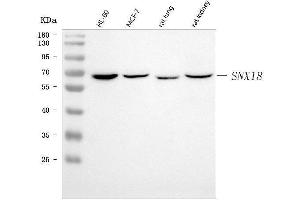 Western blot analysis of SNX18 using anti-SNX18 antibody (ABIN7600697).