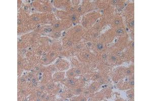 IHC-P analysis of Human Tissue, with DAB staining. (CEACAM1 抗体  (AA 35-320))