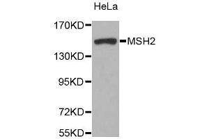 Western Blotting (WB) image for anti-Mismatch Repair Protein 2 (MSH2) (AA 1-300) antibody (ABIN3021477)
