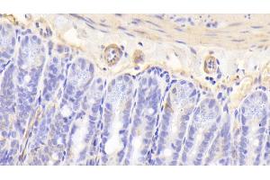 Immunohistochemistry (IHC) image for anti-Calcitonin Receptor (CALCR) (AA 42-170) antibody (ABIN7444583)