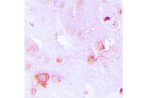 Immunohistochemical analysis of ALDOC staining in human brain formalin fixed paraffin embedded tissue section. (ALDOC 抗体  (Center))