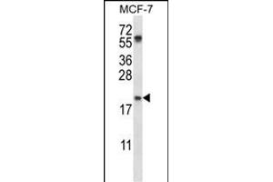PYCARD Antibody (C-term) (ABIN657783 and ABIN2846757) western blot analysis in MCF-7 cell line lysates (35 μg/lane). (PYCARD 抗体  (C-Term))