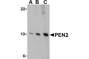 Western Blotting (WB) image for anti-Presenilin Enhancer 2 Homolog (PSENEN) (C-Term) antibody (ABIN1030574) (PEN2 抗体  (C-Term))