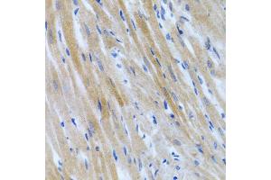 Immunohistochemistry of paraffin-embedded rat heart using BMP3 antibody (ABIN5975705) at dilution of 1/100 (40x lens). (BMP3 抗体)