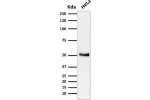 Western Blotting (WB) image for anti-Tumor Protein P53 (TP53) antibody (ABIN6940779)