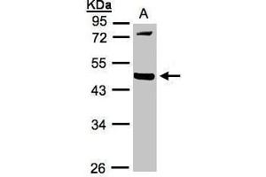 WB Image Sample(30 ug whole cell lysate) A:293T 10% SDS PAGE antibody diluted at 1:1000 (MMP12 抗体)