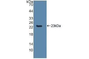 Detection of Recombinant CASP8, Human using Polyclonal Antibody to Caspase 8 (CASP8) (Caspase 8 抗体  (AA 217-384))