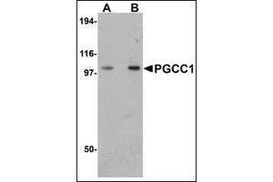 Western blot analysis of PGCC1 in rat thymus tissue lysate with this product at (A) 0. (FAM120B 抗体  (C-Term))
