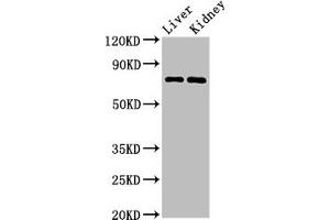 Western Blot Positive WB detected in: Mouse liver tissue, Mouse kidney tissue All lanes: PRDM5 antibody at 3 μg/mL Secondary Goat polyclonal to rabbit IgG at 1/50000 dilution Predicted band size: 74, 70, 13, 59 kDa Observed band size: 74 kDa (PRDM5 抗体  (AA 29-111))