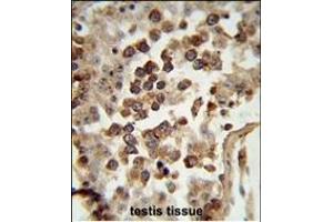 Immunohistochemistry (Paraffin-embedded Sections) (IHC (p)) image for anti-Heat Shock Protein 90kDa alpha (Cytosolic), Class B Member 1 (HSP90AB1) (AA 42-74), (N-Term) antibody (ABIN1882093)