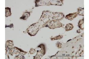 Immunoperoxidase of monoclonal antibody to ZIC4 on formalin-fixed paraffin-embedded human placenta. (ZIC4 抗体  (AA 249-319))