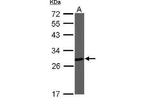 Western Blotting (WB) image for anti-Ubiquitin Carboxyl-terminal Esterase L1 (Ubiquitin Thiolesterase) (UCHL1) (C-Term) antibody (ABIN2854931)