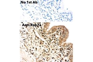 Immunohistochemistry (IHC) image for anti-RAB7A, Member RAS Oncogene Family (RAB7A) (C-Term) antibody (ABIN6254195) (RAB7A 抗体  (C-Term))