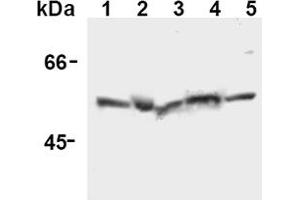 Western Blotting (WB) image for anti-Caspase 12 (Gene/pseudogene) (CASP12) (AA 95-318), (N-Term) antibody (ABIN567796) (Caspase 12 抗体  (N-Term))