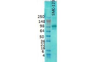Western Blot analysis of Rat brain membrane lysate showing detection of PSD95 protein using Mouse Anti-PSD95 Monoclonal Antibody, Clone 7E3 . (DLG4 抗体  (APC))