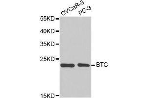 Western blot analysis of extracts of various cell lines, using BTC antibody. (Betacellulin 抗体  (AA 32-178))