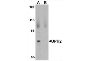 Western blot analysis of JPH2 in 293 cell lysate with this product at 2 μg/ml in (A) the absence and (B) the presence of blocking peptide. (Junctophilin 2 抗体  (C-Term))