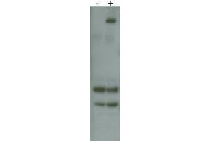 RK8 (LRRK2) Antibody  f detects over-expressed human LRRK2 protein. (LRRK2 抗体  (AA 878-909))