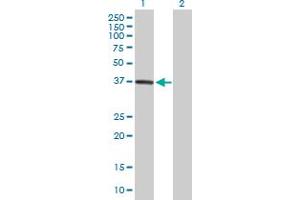 Western Blot analysis of DPH5 expression in transfected 293T cell line by DPH5 MaxPab polyclonal antibody. (DPH5 抗体  (AA 1-285))