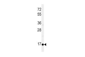 Western Blotting (WB) image for anti-Epiregulin (EREG) (AA 137-165), (C-Term) antibody (ABIN650993)
