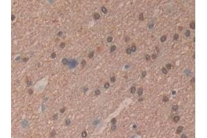 Detection of mTOR in Human Brain Tissue using Polyclonal Antibody to Serine/threonine-protein kinase mTOR (mTOR) (MTOR 抗体  (AA 2226-2488))