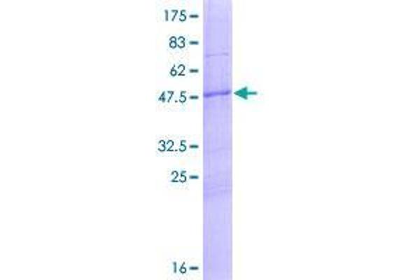 Chromosome 5 Open Reading Frame 39 (C5orf39) (AA 1-193) protein (GST tag)