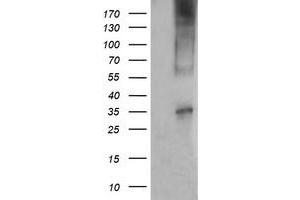 Western Blotting (WB) image for anti-T-cell surface glycoprotein CD1c (CD1C) antibody (ABIN2670660) (CD1c 抗体)