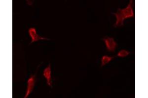 ABIN6277686 staining COLO205 by IF/ICC. (TWEAK 抗体  (N-Term))