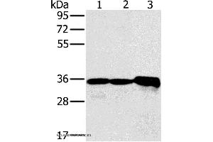 Western blot analysis of Mouse kidney tissue and Jurkat cell, mouse heart tissue, using NDUFA9 Polyclonal Antibody at dilution of 1:400 (NDUFA9 抗体)