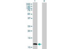 Western Blot analysis of CALCB expression in transfected 293T cell line by CALCB MaxPab polyclonal antibody.
