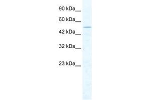 CHD1L antibody used at 2. (CHD1L 抗体  (Middle Region))