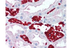 Anti-GYPA / Glycophorin A antibody IHC of human kidney, red blood cells. (CD235ab 抗体)