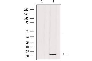 Western blot analysis of extracts from mouse brain, using RPC10 Antibody. (POLR3K 抗体  (Internal Region))