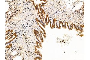 ABIN7094623 and ABIN7098673 at 1/100 staining Rat lung tissue by IHC-P. (MTDH 抗体  (C-Term))