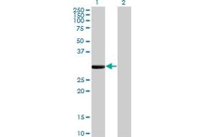 Western Blot analysis of FCN1 expression in transfected 293T cell line by FCN1 monoclonal antibody (M06), clone 2B7. (FCN1 抗体  (AA 201-300))