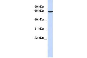 Western Blotting (WB) image for anti-ADAM Metallopeptidase Domain 9 (ADAM9) antibody (ABIN2459015)